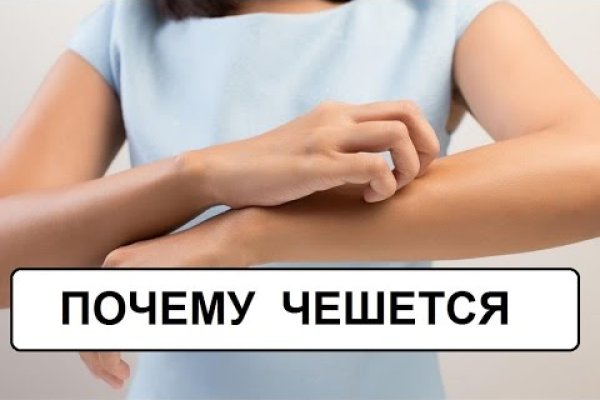 Что вместо гидры